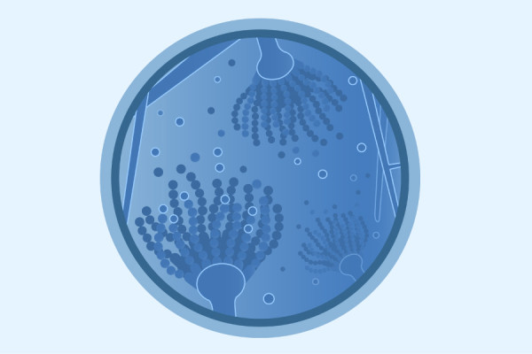 Aspergillosis